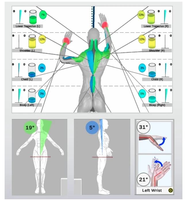 Muscular activity as “heat maps”, postural deviations